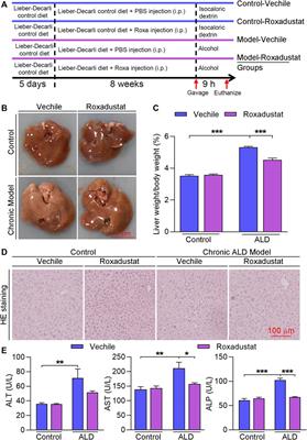 Roxadustat, a Hypoxia-Inducible Factor 1α Activator, Attenuates Both Long- and Short-Term Alcohol-Induced Alcoholic Liver Disease